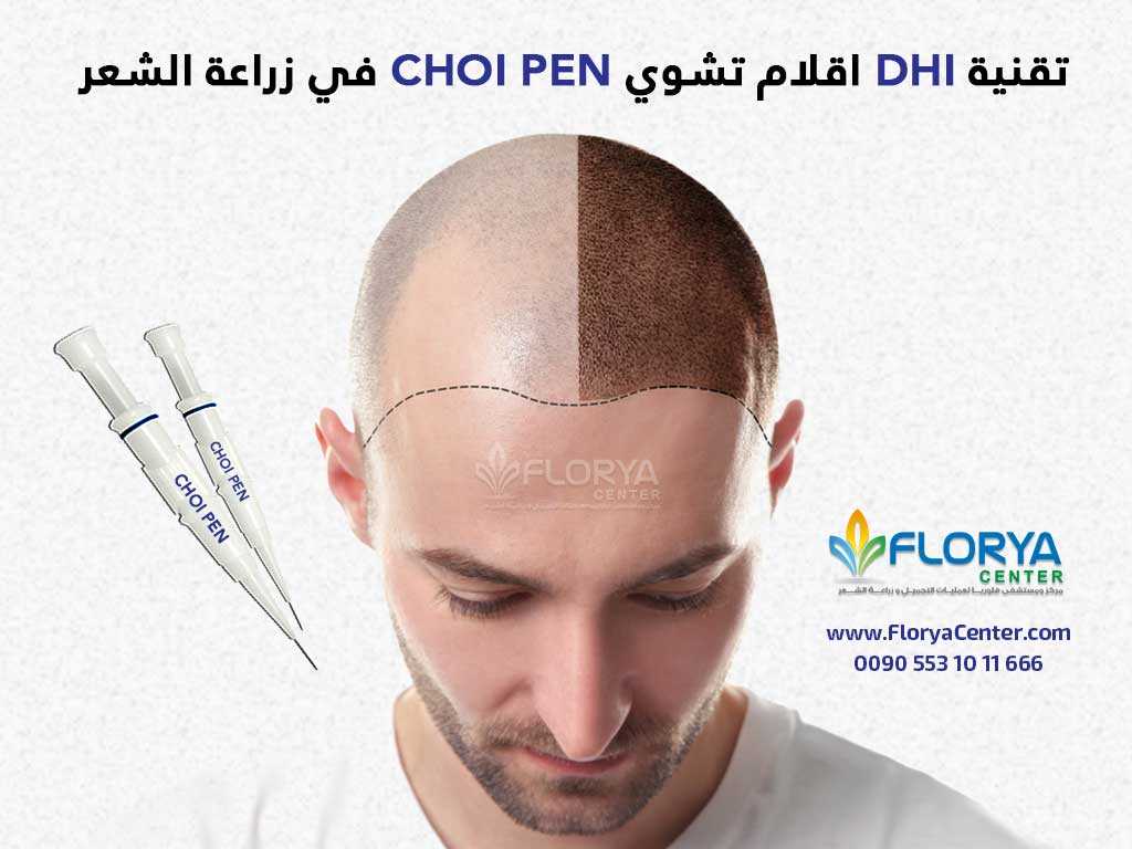 تقنية DHI اقلام تشوي في زراعة الشعر