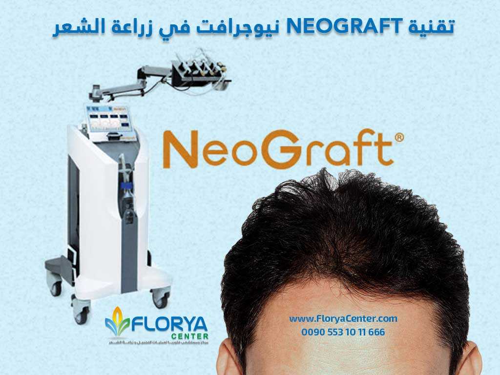 تقنية NEOGRAFT نيوجرافت في زراعة الشعر