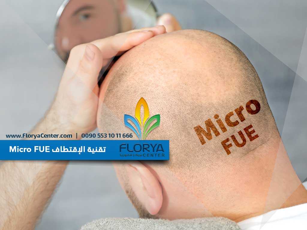 تقنية الإقتطاف Micro FUE