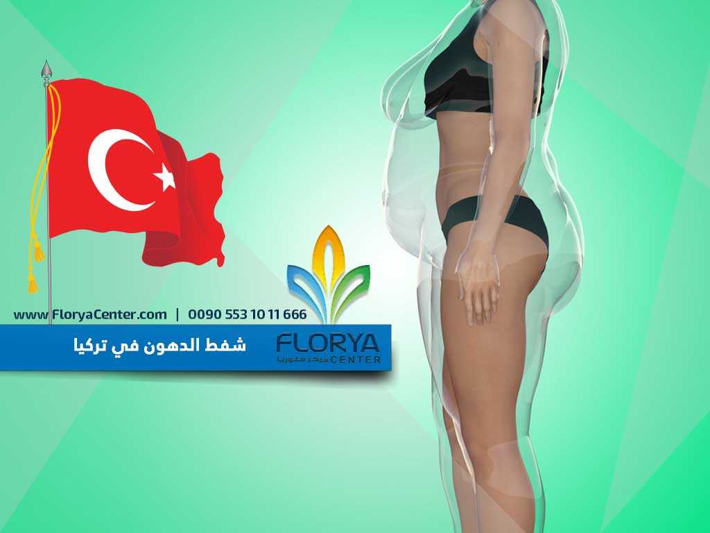 شفط الدهون في تركيا