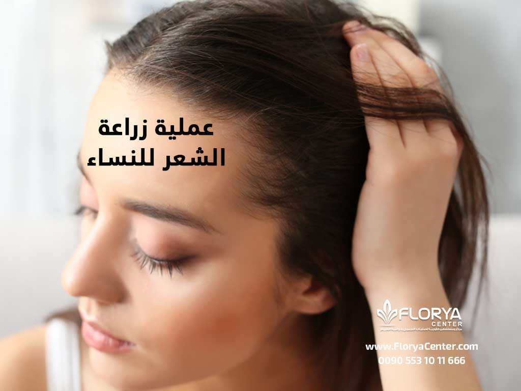عملية زراعة الشعر للنساء
