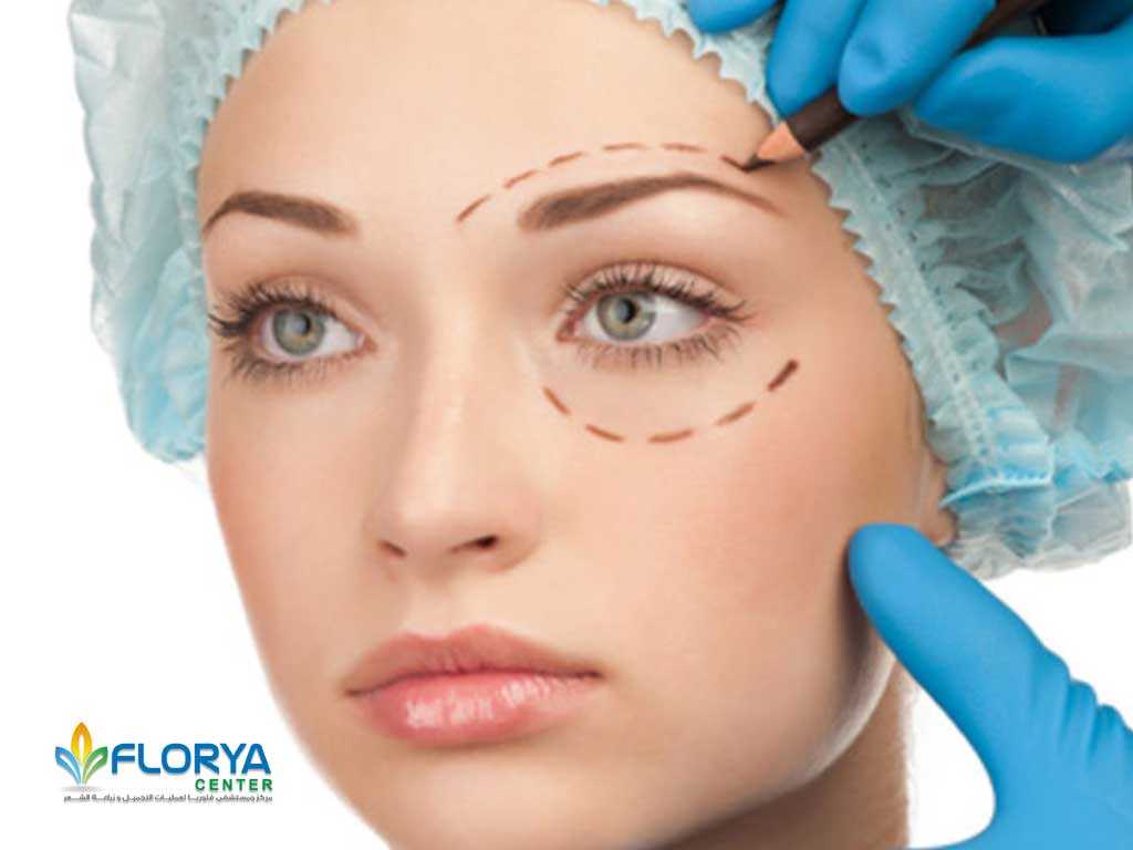 عملية تجميل العيون