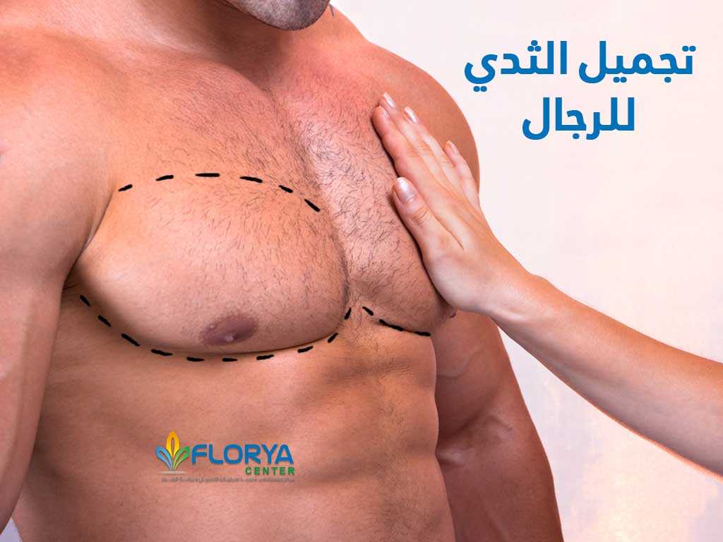 تجميل الثدي للرجال