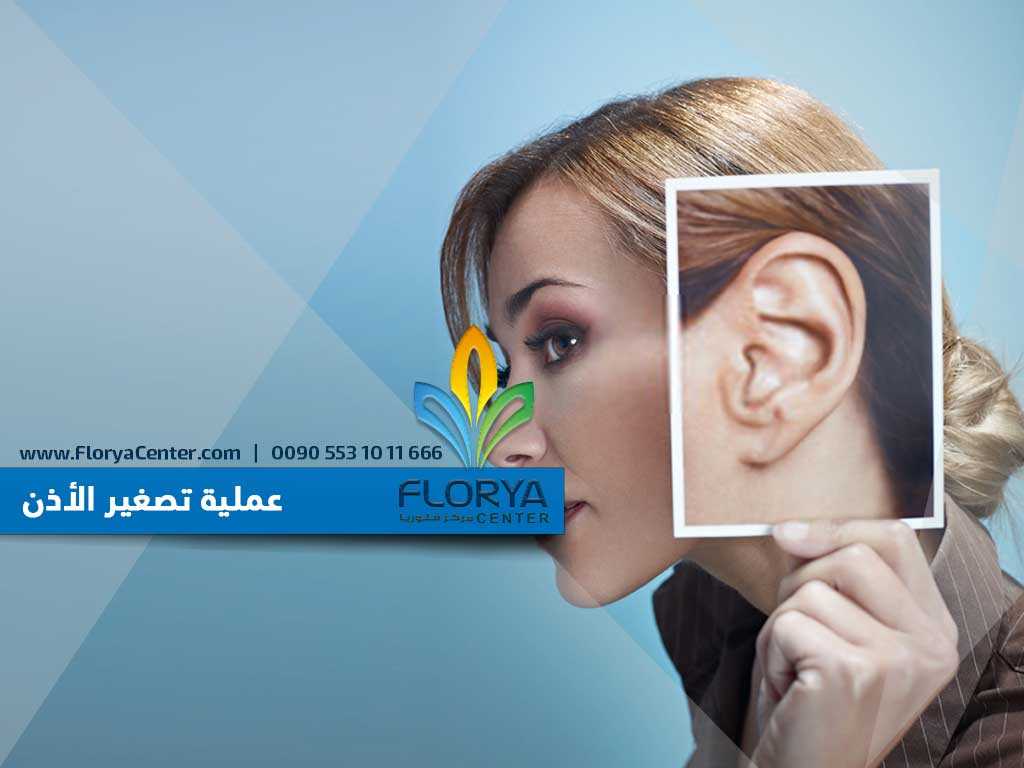 عملية تصغير الأذن