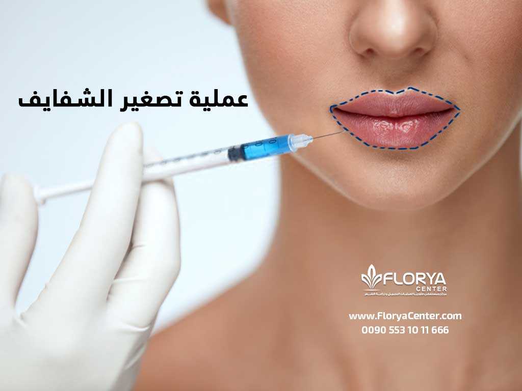 عملية تصغير الشفايف