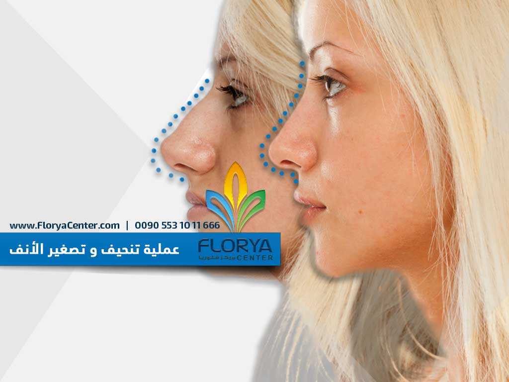 عملية تنحيف و تصغير الأنف