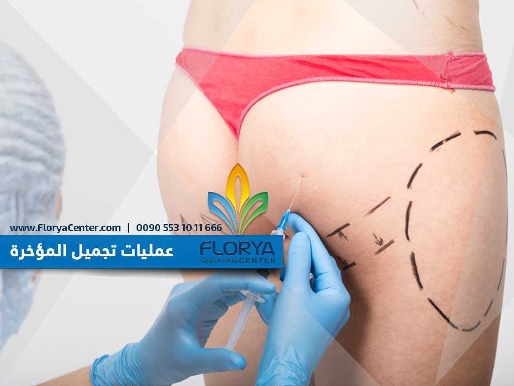 عمليات تجميل المؤخرة