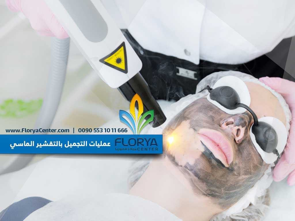 عمليات التجميل بالتقشير الماسي