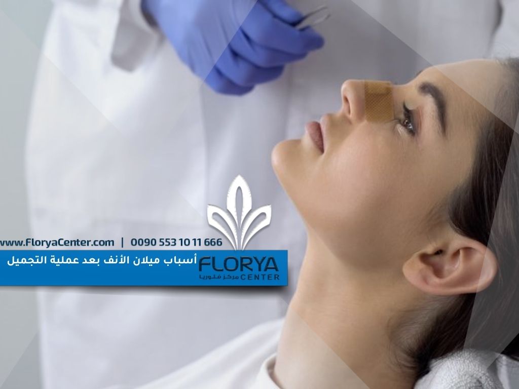 أسباب ميلان الأنف بعد عملية التجميل