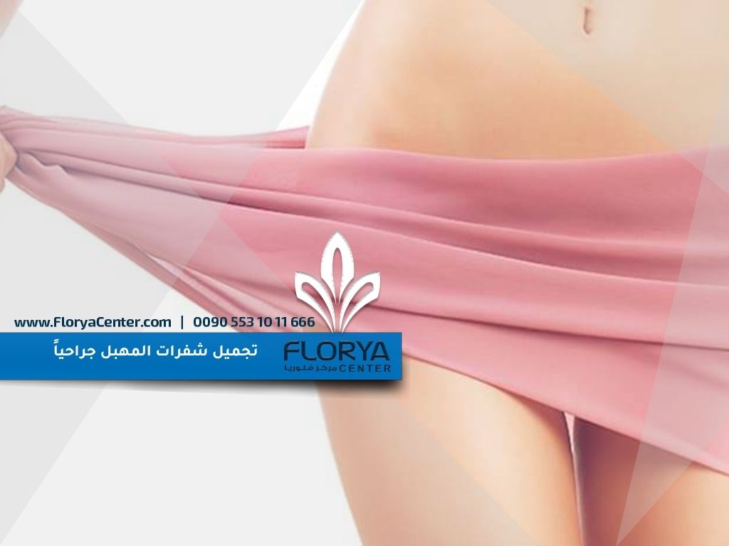 تجميل شفرات المهبل جراحياً