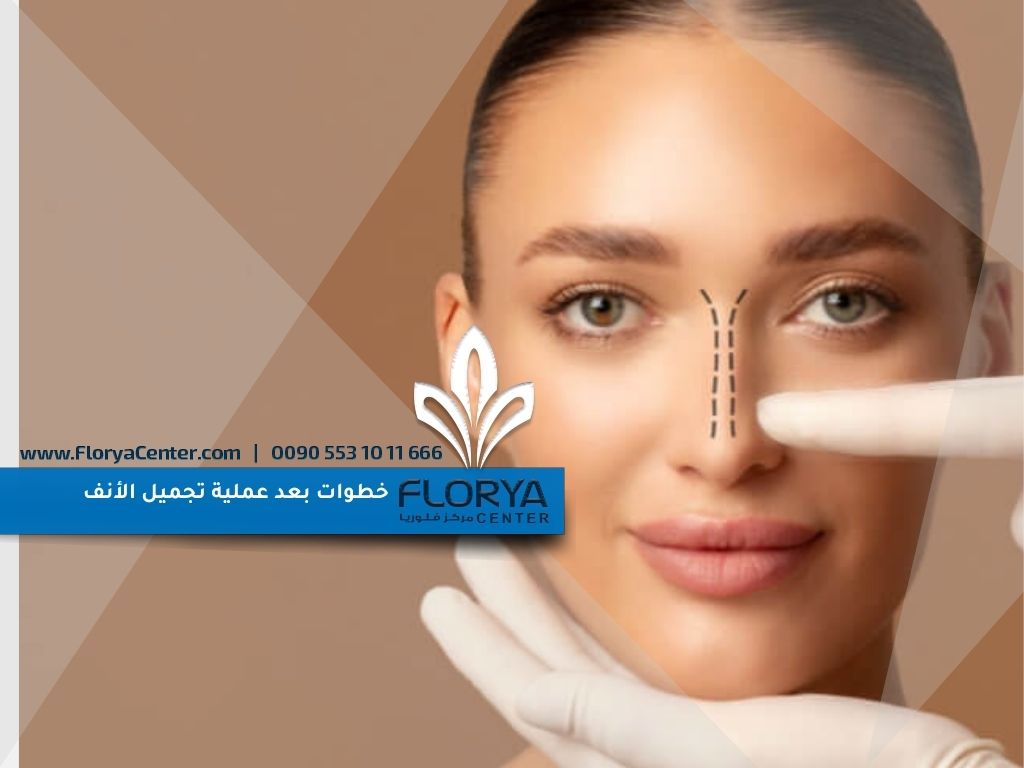 خطوات بعد عملية تجميل الأنف