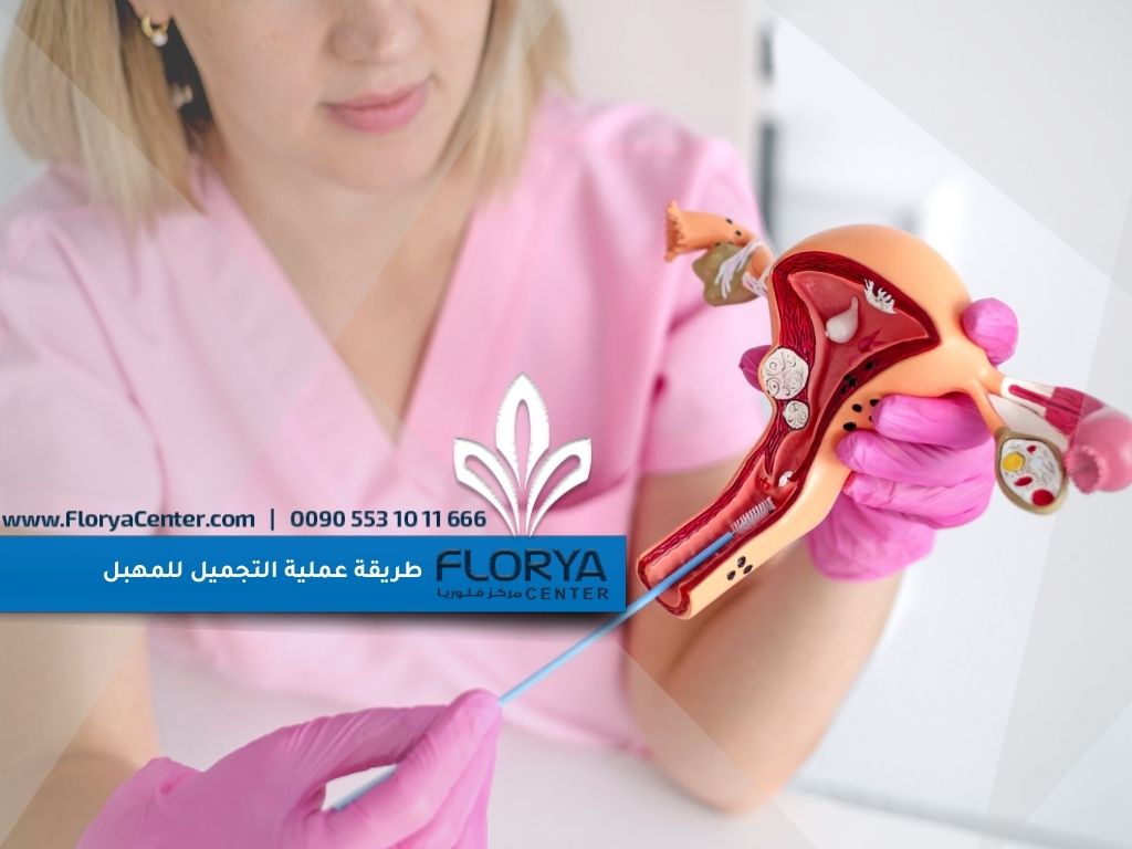 طريقة عملية التجميل للمهبل