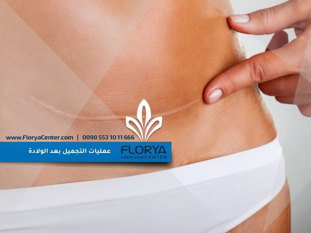 عمليات التجميل بعد الولادة