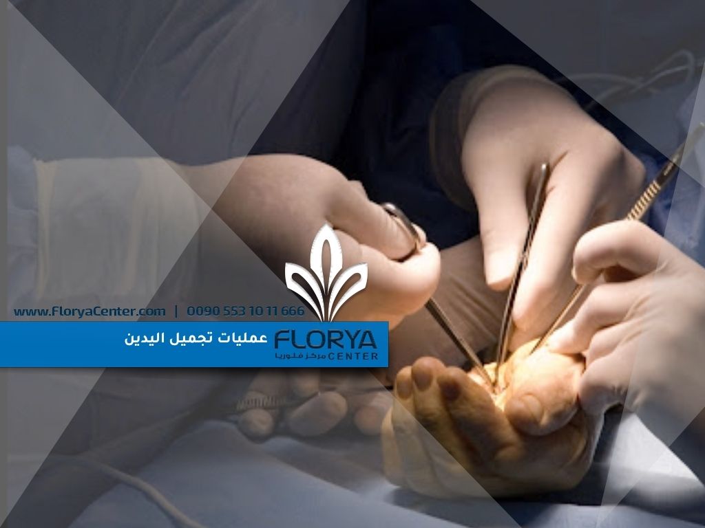عمليات تجميل اليدين