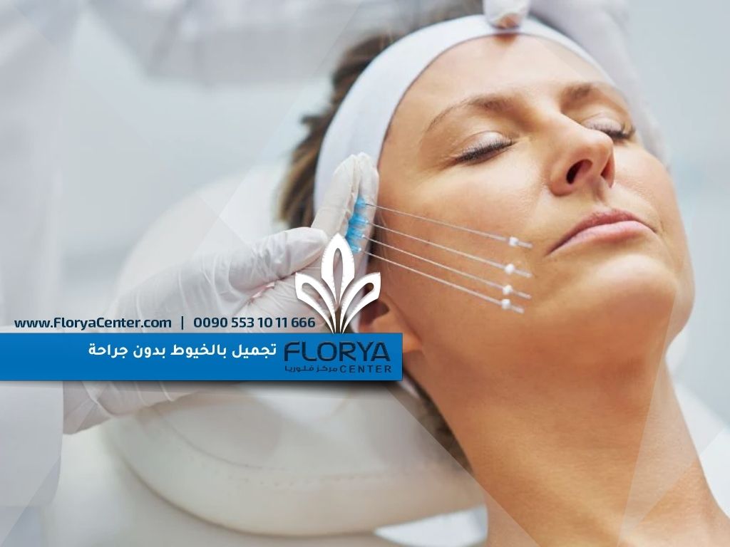 تجميل بالخيوط بدون جراحة