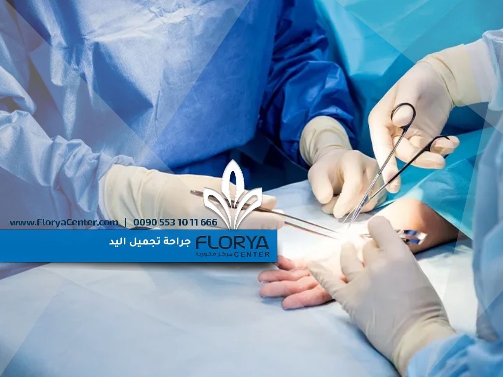 جراحة تجميل اليد