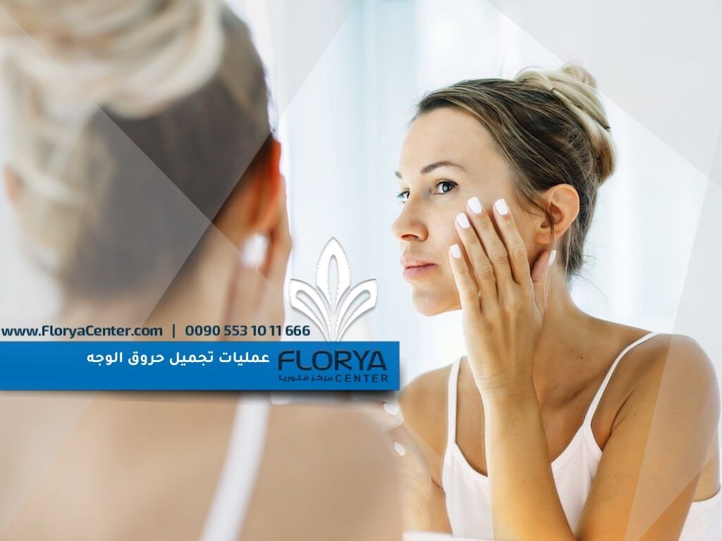عمليات تجميل حروق الوجه