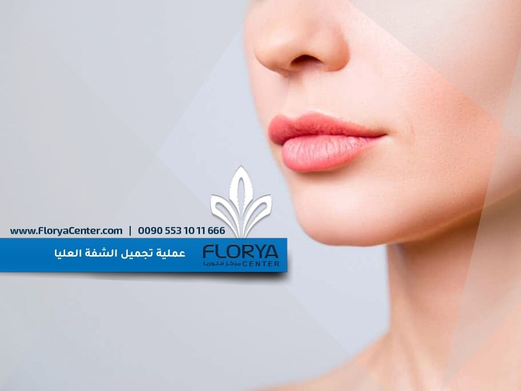 عملية تجميل الشفة العليا