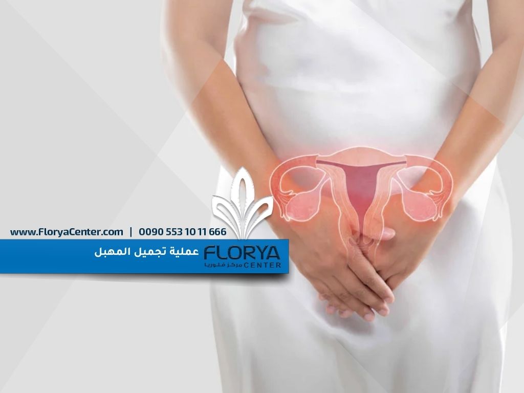 عملية تجميل المهبل