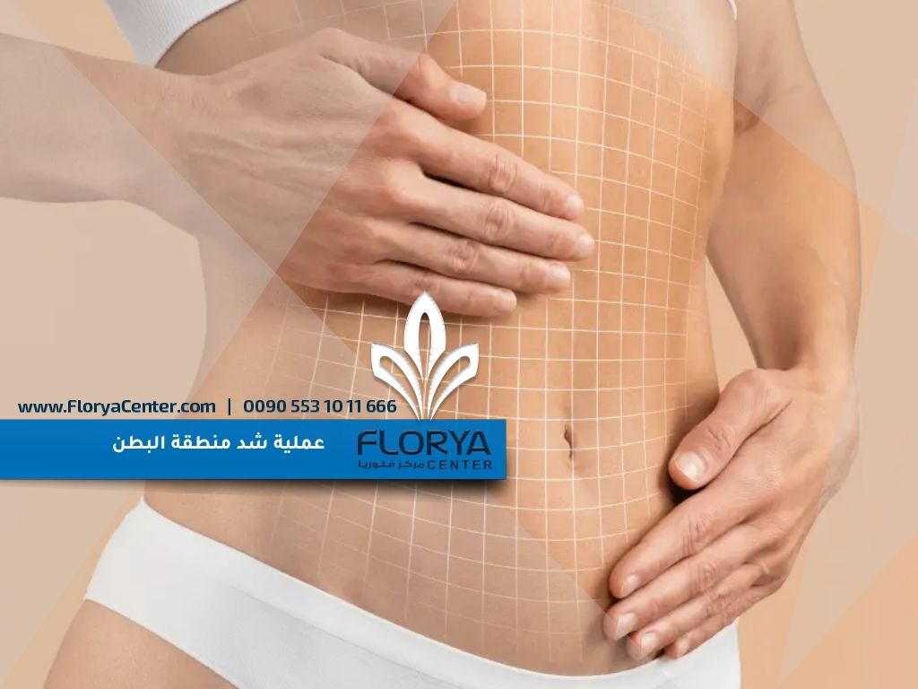 عملية شد منطقة البطن